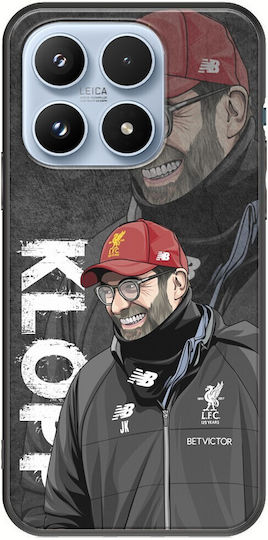 Калъф Jurgen Klopp Xiaomi 17 5g Черен TPU Силикон