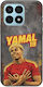 Калъф World Stars Collection Lamine Yamal Honor X8a Черен TPU Силикон