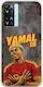 Θήκη World Stars Collection Lamine Yamal Oppo A77 5g Flexible Tpu Διάφανη Σιλικόνη