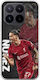 Mobile Phone Case Football Stars Darwin Nunez Xiaomi 17t Pro 5g Flexible TPU Transparent Silicone