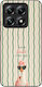 Sonique Stripe Stories Series Xiaomi Xiaomi 14t...