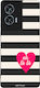 Sonique Stripe Stories Series Case Motorola Edg...