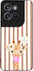 Sonique Stripe Stories Series Case Motorola Edg...
