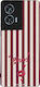 Sonique Stripe Stories Series Motorola Edge 50 ...