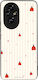Θήκη Sonique Stripe Stories Series Honor 200 5g...