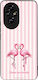 Θήκη Sonique Stripe Stories Series Honor 200 5g...
