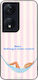 Θήκη Sonique Stripe Stories Series Honor 90 Sma...