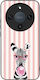 Sonique Stripe Stories Series Honor Magic8 Lite...
