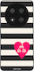 Θήκη Sonique Stripe Stories Series Honor Magic7...