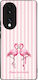 Калъф Sonique Stripe Stories Series Honor 70 5g...