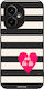 Husă Sonique Stripe Stories Series Honor 400 5g...