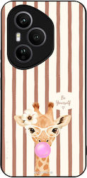 Sonique Stripe Stories Series Honor 400 Pro 5g ...