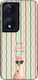 Θήκη Sonique Stripe Stories Series Honor 90 Sma...