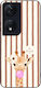 Θήκη Sonique Stripe Stories Series Honor 90 Sma...