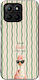 Sonique Stripe Stories Series Ehre 70 Lite 5G B...