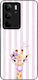 Sonique Stripe Stories Series Case Realme C75 4...