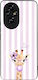 Θήκη Sonique Stripe Stories Series Honor 200 5g...