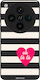 Sonique Stripe Stories Series Oppo Find X8 Pro ...