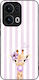 Sonique Stripe Stories Series Oppo Reno13 Pro 5...