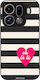 Sonique Stripe Stories Series Oppo Find X9 Pro ...
