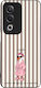 Калъф Sonique Stripe Stories Серия Oppo A80 5G ...