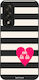Калъф Sonique Stripe Stories Series Oneplus Nor...
