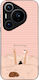 Sonique Stripe Stories Series Huawei Pura 70 Pr...