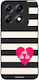 Sonique Stripe Stories Series Case Motorola Edg...