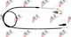 Handbremsseil Peugeot 405 87-95 474571