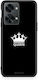 Smartfits Valentine Queen Oneplus Nord 2t Θήκη