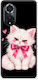 Smartfits Grumpy Party Kitten Σε Μαύρη Θήκη Για Huawei Nova 9 Honor 50